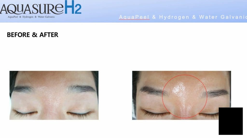 Máy Chăm Sóc Da Mặt Tổng Thể AquaSure H2 - Hàn Quốc (9)