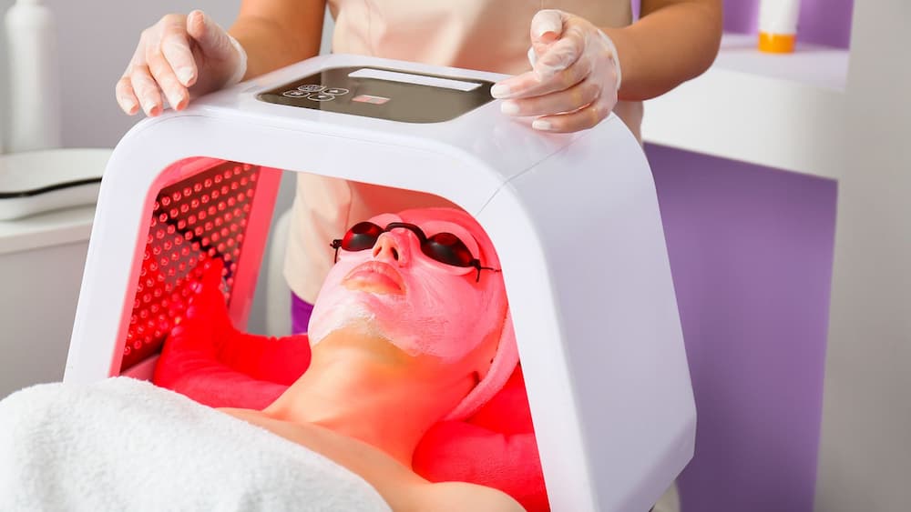Máy trị nám, tàn nhang kết hợp laser