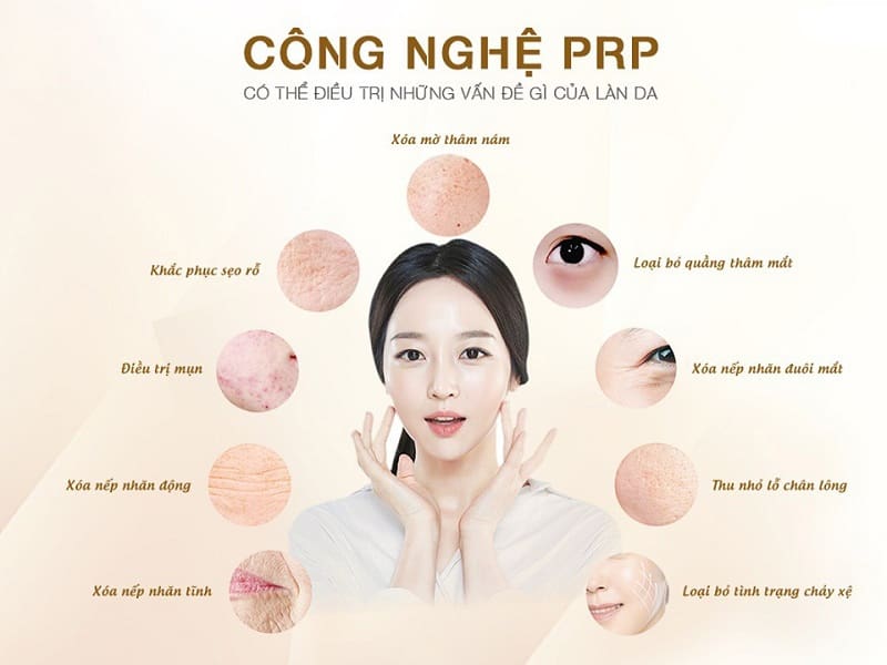 Lợi ích công nghệ trẻ hoá da bằng PRP