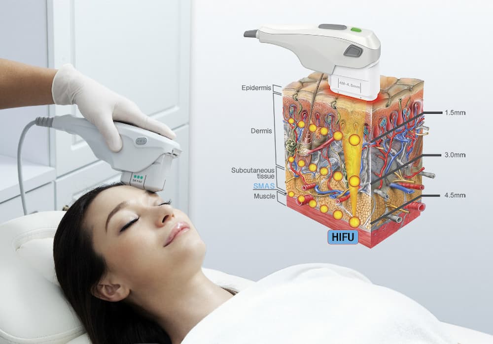 Máy nâng cơ tác động sâu vào tầng biểu bì