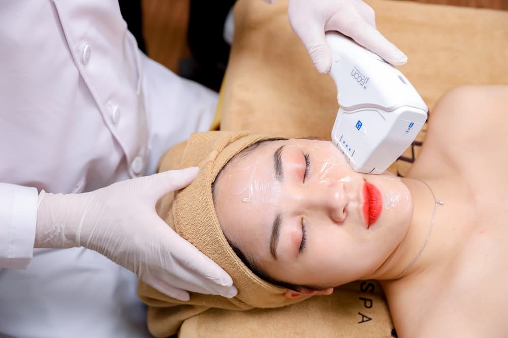 Hifu nâng cơ mặt có thể duy trì hiệu quả đến 2 năm